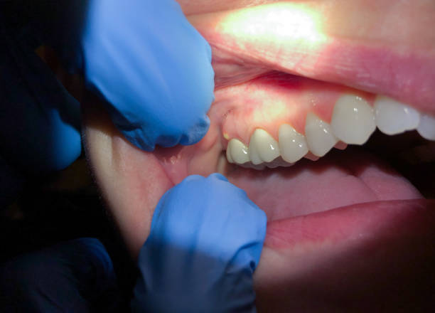 Best Cracked Tooth Emergency Dentist  in Slocom, AL
