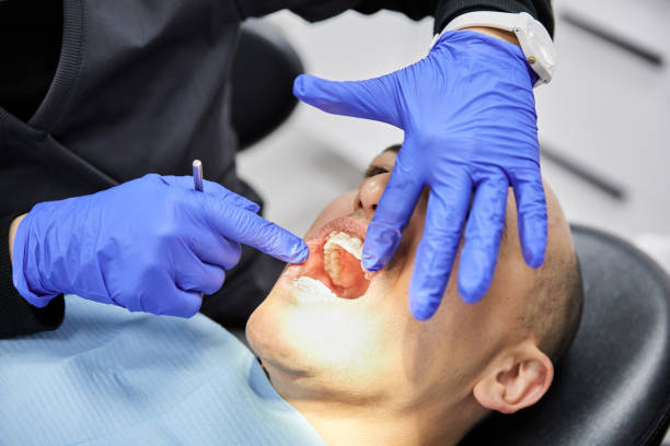 Best Urgent Tooth Repair  in Slocom, AL